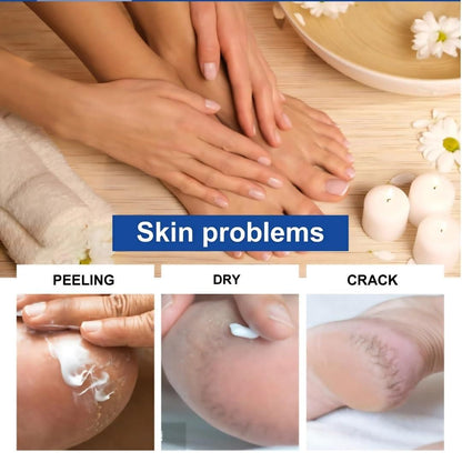 Foot Cream Fast Relief for Fingers & Feet Revive Cream (Pack of 2)